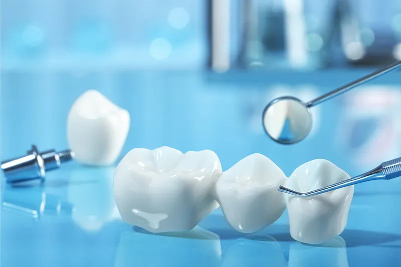 Zahnzusatz-Versicherung – hochwertige Zahnbrücke aus Keramik mit zahnmedizinischem Instrument auf blauem Untergrund